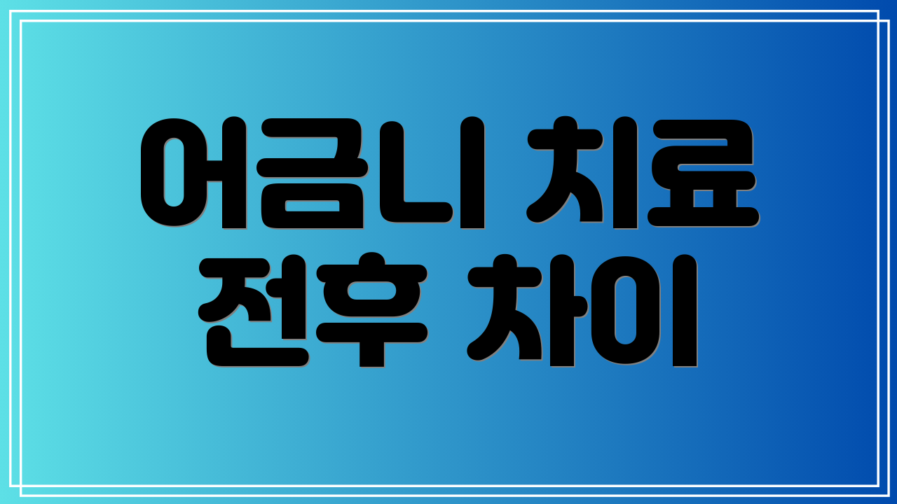 어금니 치료 전후 차이